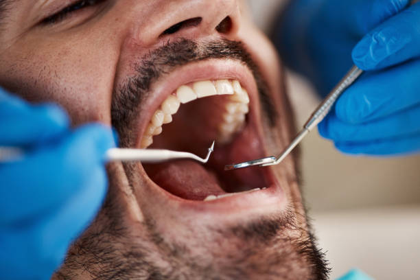 Best Emergency Tooth Extraction in Mulberry, AR